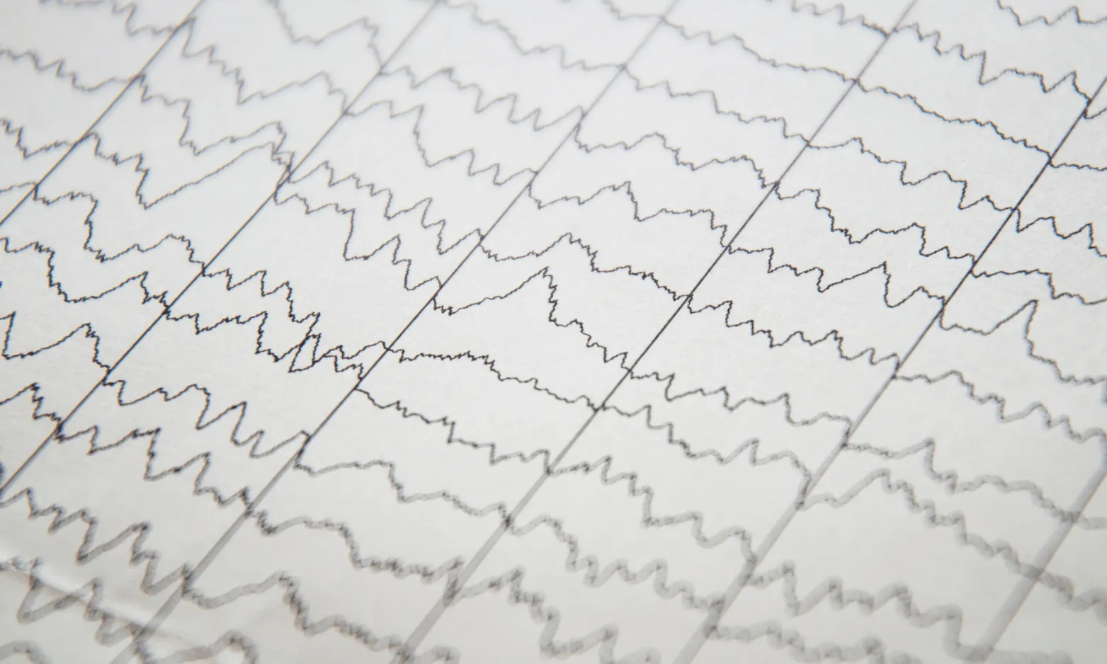 Close-up of an EEG signal trace on clinical recording paper